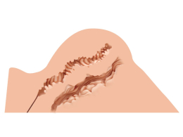 Мастурбатор-попа Naked Factory HANNAH, вагіна + анус, дуже реалістичний, наскрізний - - фото №2